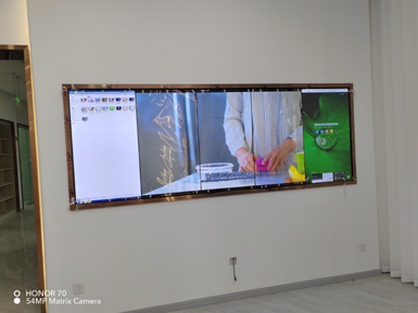 唐牙科双流店高清点对点液晶拼接屏完成