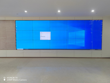 新桥口腔南门店液晶拼接屏完成